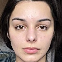 Face 485